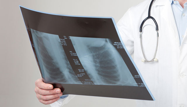 病院でレントゲンを撮ったが異常なしと言われた
